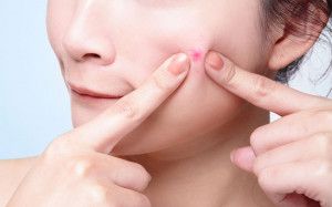 6 vấn đề về da khi mang thai