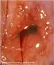 Bệnh lây truyền qua đường tình dục (P. 1) - Bệnh viện Từ Dũ