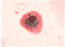 Cytomegalo Virus - Bệnh viện Từ Dũ