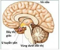 U tuyến yên - bệnh viện Việt Đức