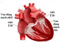Bệnh lý van tim và các loại van tim nhân tạo- Bệnh viện Việt Đức