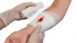Sơ cứu nạn nhân có vết thương chảy máu - Bệnh viện nhi Trung Ương