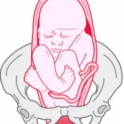 Ngôi ngược - Bệnh viện Từ Dũ
