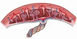 Nhau cài răng lược – bệnh lý đe dọa tính mạng mẹ và con - Bệnh viện Từ Dũ