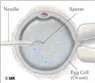 ICSI - Công nghệ Hỗ trợ sinh sản - Bệnh viện Từ Dũ