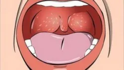 Chăm sóc trẻ phẫu thuật nạo VA, cắt amidan - Bệnh viện nhi Trung Ương