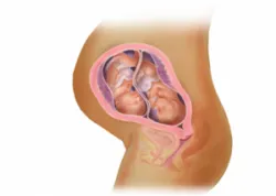 Đa thai: niềm vui xen lẫn nỗi lo - Bệnh viện Từ Dũ