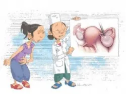 U nang buồng trứng