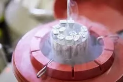Trữ lạnh tinh trùng - Bệnh viện Từ Dũ