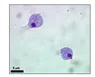 Xét nghiệm soi tươi - Nhuộm huyết trắng - Bệnh viện Từ Dũ