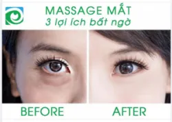 3 LỢI ÍCH BẤT NGỜ TỪ VIỆC MASSAGE MẮT
