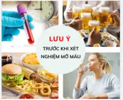 4 LƯU Ý CẦN BIẾT TRƯỚC KHI XÉT NGHIỆM MỠ MÁU