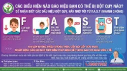 Các biểu hiện nào báo hiệu bạn có thể bị đột quỵ não?