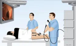 Nội soi đại tràng phát hiện sớm bệnh lý túi thừa đại tràng - Bệnh viện Việt Đức