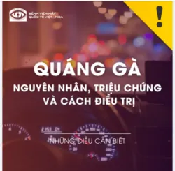 Bệnh quáng gà (chứng mù đêm) là cách gọi thông thường của bệnh lý thoái hóa sắc tố võng mạc mắt.