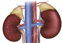 Bệnh thận đái tháo đường: Những lời khuyên hữu ích từ chuyên gia - Bệnh viện Việt Đức