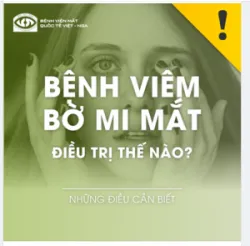 BỆNH VIÊM BỜ MI MẮT ĐIỀU TRỊ THẾ NÀO ?