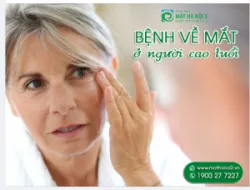 CÁC BỆNH VỀ MẮT THƯỜNG GẶP Ở NGƯỜI CAO TUỔI
