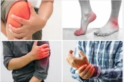 CÁCH ĐỐI PHÓ VỚI ĐAU KHỚP MÙA LẠNH