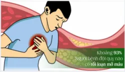 CÁCH PHÒNG TRÁNH NGUY CƠ ĐỘT QUỴ DO RỐI LOẠN MỠ MÁU BẠN CÓ BIẾT