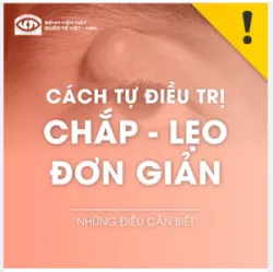 CÁCH TỰ ĐIỀU TRỊ CHẮP - LẸO ĐƠN GIẢN