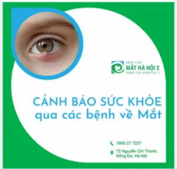CẢNH BÁO SỨC KHỎE QUA CÁC BỆNH VỀ MẮT