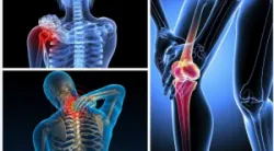 CHẾ ĐỘ DINH DƯỠNG TỐT CHO NGƯỜI BỆNH XƯƠNG KHỚP