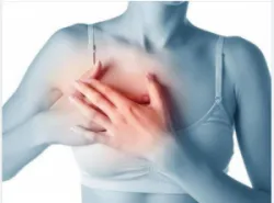 Chụp Xquang vú - Phát hiện sớm ung thư vú hiệu quả