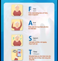 DẤU HIỆU CẢNH BÁO ĐỘT QUỴ ĐỪNG BỎ QUA QUY TẮC FAST