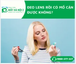 ĐEO KÍNH ÁP TRÒNG TRONG THỜI GIAN DÀI CÓ MỔ MẮT ĐƯỢC NỮA HAY KHÔNG