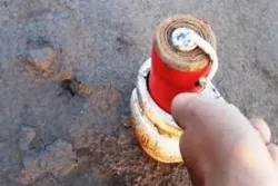 Nam thanh niên bị dập nát bàn tay do pháo tự chế phát nổ - Bệnh viện Việt Đức