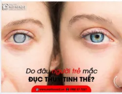 ĐỤC THỦY TINH THỂ Ở NGƯỜI TRẺ DO ĐÂU?