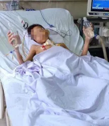 8 tháng sau ca ghép phổi đầu tiên thành công tại Bệnh viện Việt Đức, sức khỏe bệnh nhân dần tốt lên