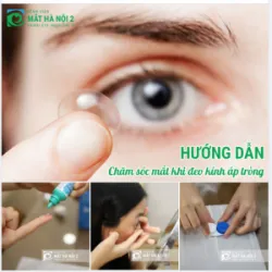 Hướng dẫn chăm sóc mắt đúng cách khi đeo kính áp tròng