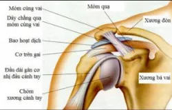 Đau vai không nên chủ quan - Bệnh viện Việt Đức
