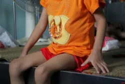 Thalassemia – Chẩn đoán và điều trị (phần 3) - Bệnh viện nhi Trung Ương