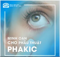MINH OAN CHO PHẪU THUẬT PHAKIC