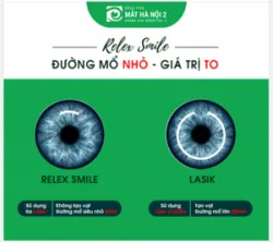 Mổ cận bằng phương pháp RELEX SMILE: Đường mổ NHỎ - giá trị TO