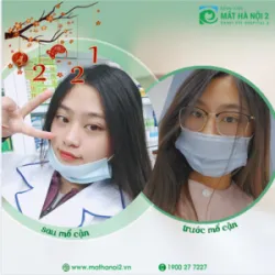 MỔ CẬN LIỀN NHANH ĂN TẾT THẢ PHANH