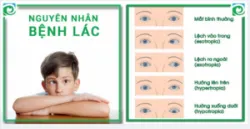 NGUYÊN NHÂN BỆNH LÁC
