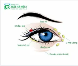 NHẬN BIẾT CÁC BỆNH LÝ TẠI MI MẮT