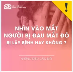 NHÌN VÀO MẮT NGƯỜI BỊ ĐAU MẮT ĐỎ BỊ LÂY BỆNH HAY KHÔNG ?