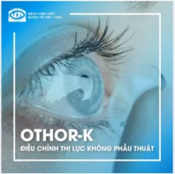 ORTHO-K - ĐIỀU CHỈNH THỊ LỰC KHÔNG PHẪU THUẬT