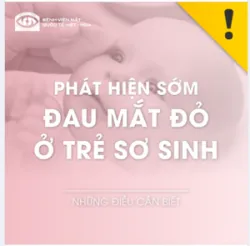 PHÁT HIỆN SỚM ĐAU MẮT ĐỎ Ở TRẺ SƠ SINH