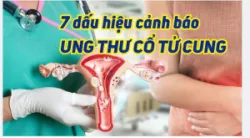 PHÁT HIỆN UNG THƯ CỔ TỬ CUNG - ĐỪNG ĐỂ QUÁ TRỄ!