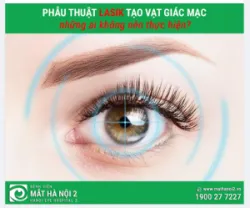 PHẪU THUẬT LASIK TẠO VẠT GIÁC MẠC: những ai không nên thực hiện