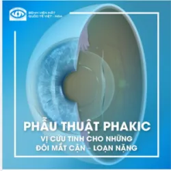 PHẪU THUẬT PHAKIC VỊ CỨU TINH CHO NHỮNG ĐÔI MẮT CẬN LOẠN NẶNG