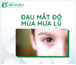 Phòng bệnh đau mắt đỏ mùa mưa lũ