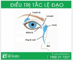 PHÒNG NGỪA ĐIỀU TRỊ TẮC LỆ ĐẠO
