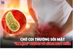 SỎI MẬT KHI NÀO NGUY HIỂM?